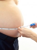 Wpływ chirurgii bariatrycznej na metabolizm glukozy u pacjentów z otyłością olbrzymią